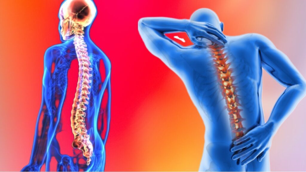 "Text-Neck Syndrome: A Growing Concern on World Spine Day" 2023